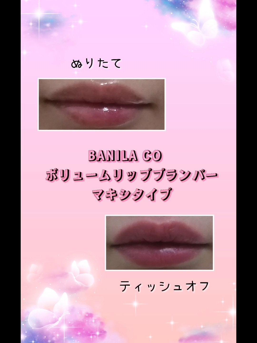 ボリュームリッププランパー/BANILA CO/リッププランパーを使ったクチコミ(8枚目)