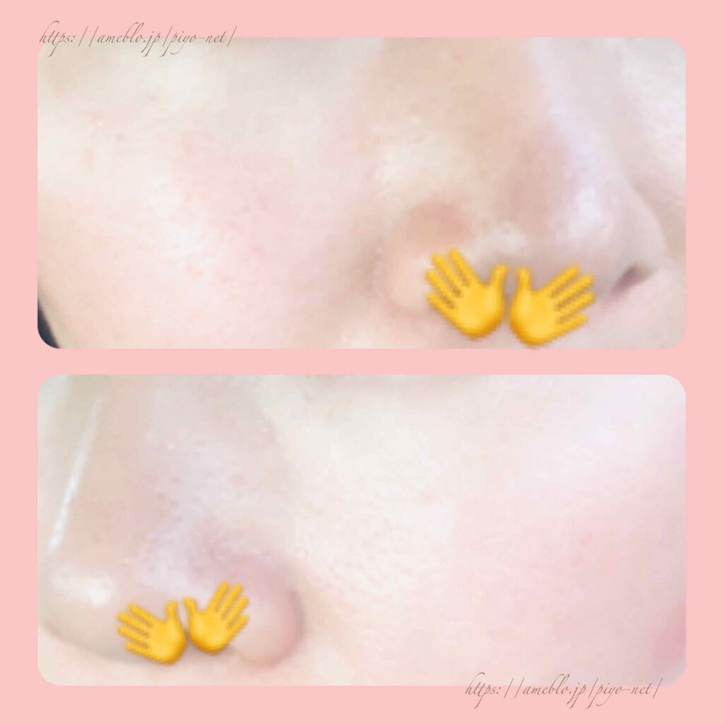 自己紹介/雑談/その他を使ったクチコミ（2枚目）