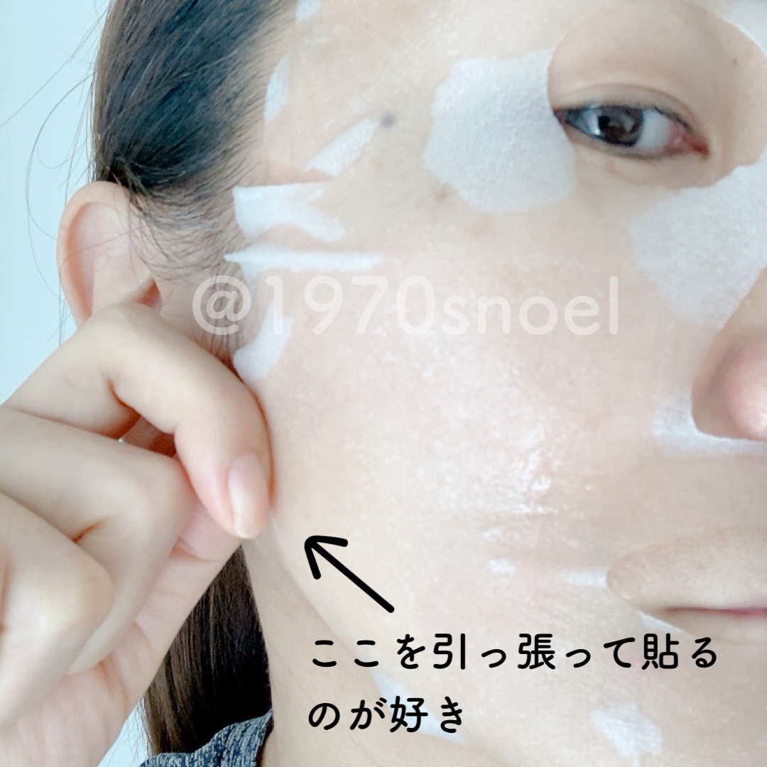 ダーマレーザー スーパーセラミド100マスク/クオリティファースト/シートマスク・パックを使ったクチコミ（2枚目）