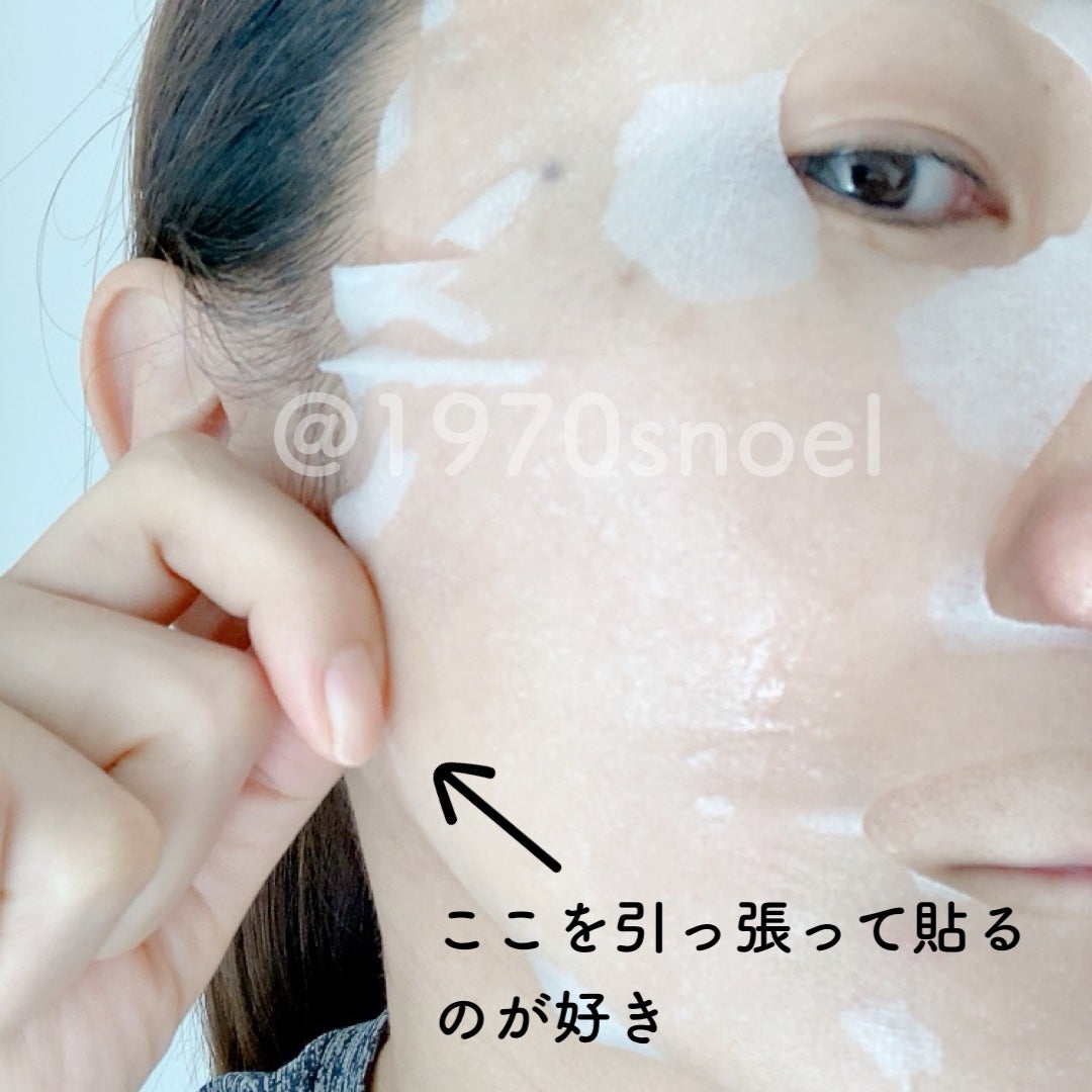 ダーマレーザー スーパーTEATREE100マスク/クオリティファースト/シートマスク・パックを使ったクチコミ(2枚目)