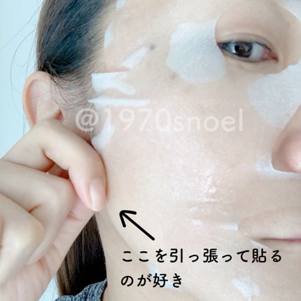 ダーマレーザー スーパーTEATREE100マスク/クオリティファースト/シートマスク・パックを使ったクチコミ(2枚目)