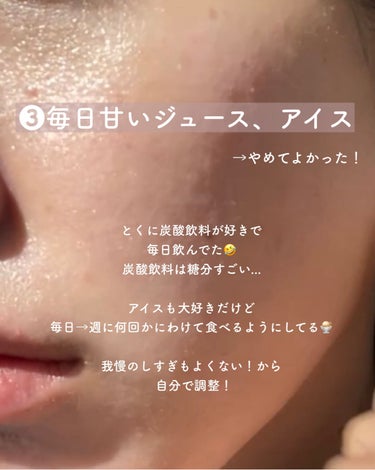 yuyu🐶肌荒れ体質の正直レビュー on LIPS 「【ニキビ跡ケア🔥やめてよかった6つのコト】✼••┈┈••✼••..」（4枚目）