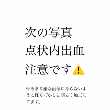 ハトムギ ベビーオイル/麗白/ボディオイルを使ったクチコミ(2枚目)