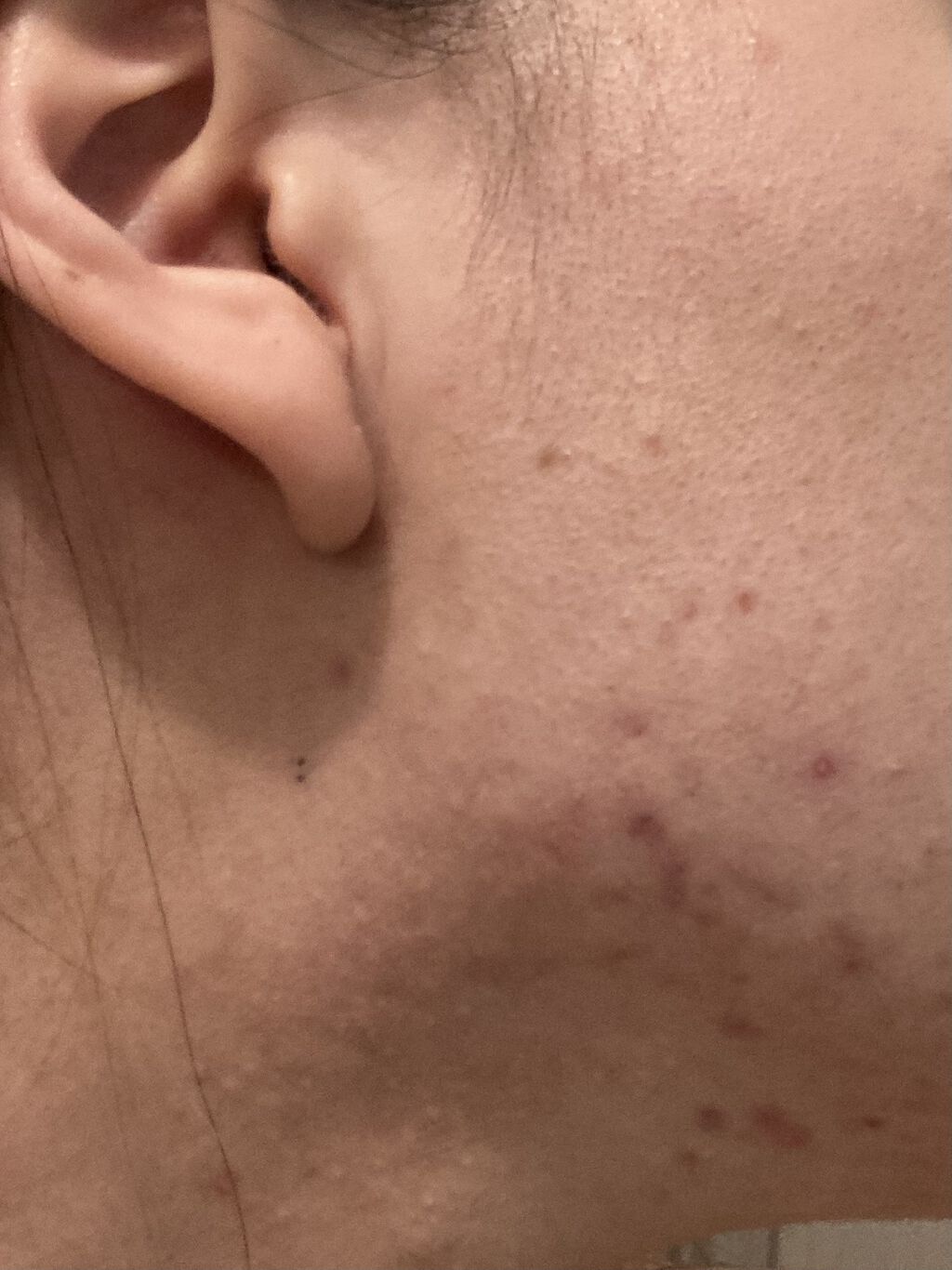 ハトムギ化粧水(ナチュリエ スキンコンディショナー R )/ナチュリエ/化粧水を使ったクチコミ（1枚目）