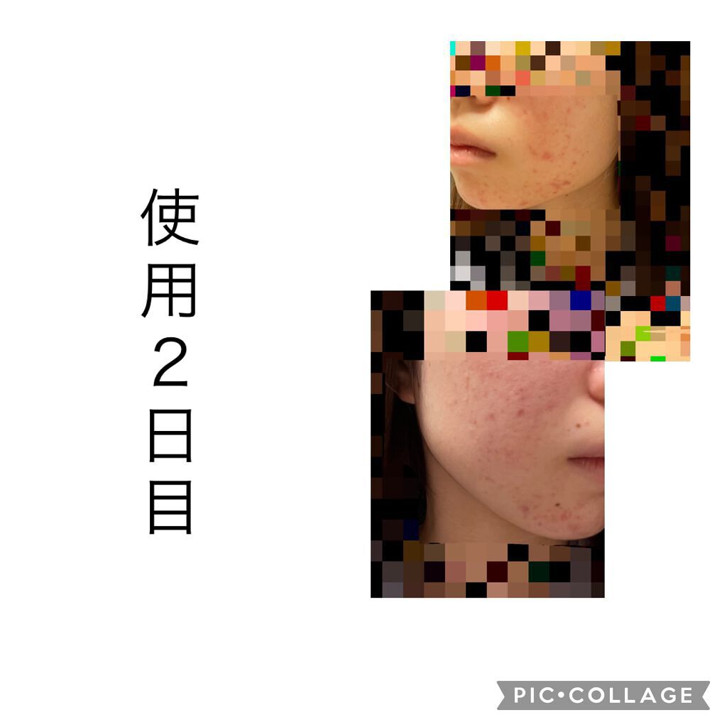 ピグメンビオ フォーミングスクラブホワイト/ビオデルマ/スクラブ・ゴマージュを使ったクチコミ（3枚目）