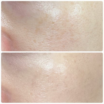 SIGNATURE ESSENCE COVER PACT /AGE20’s/クリーム・エマルジョンファンデーションを使ったクチコミ(6枚目)