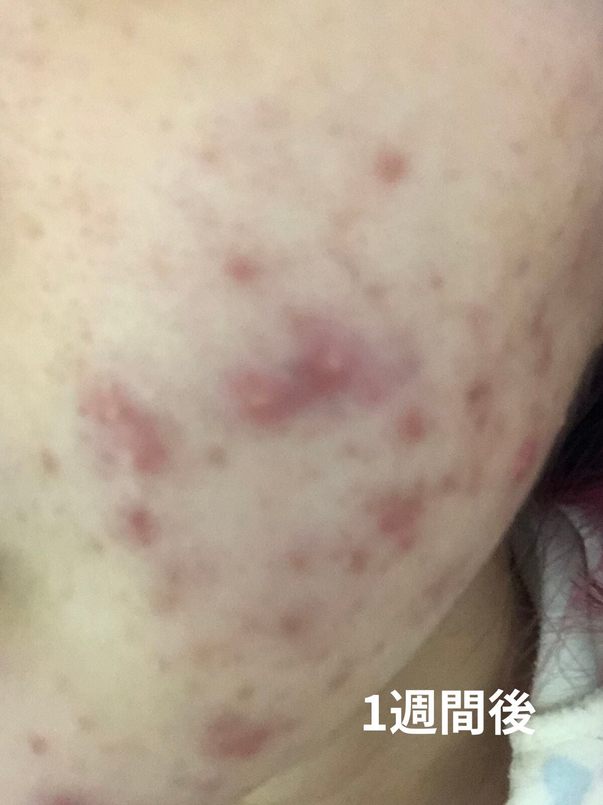 ドクダミ 77 スージングトナー/Anua/化粧水を使ったクチコミ(5枚目)