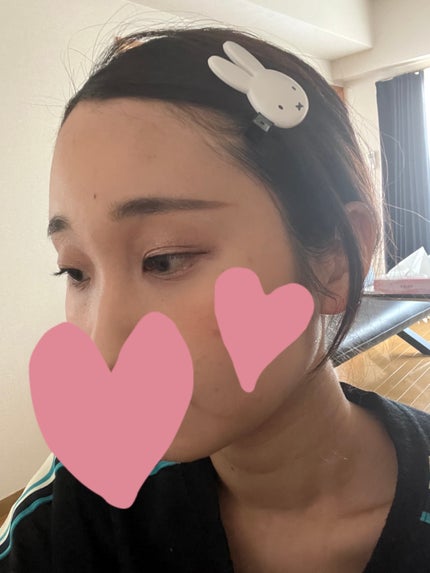 ダイカット前髪クリップ/miffy/ヘアアクセサリーを使ったクチコミ(3枚目)