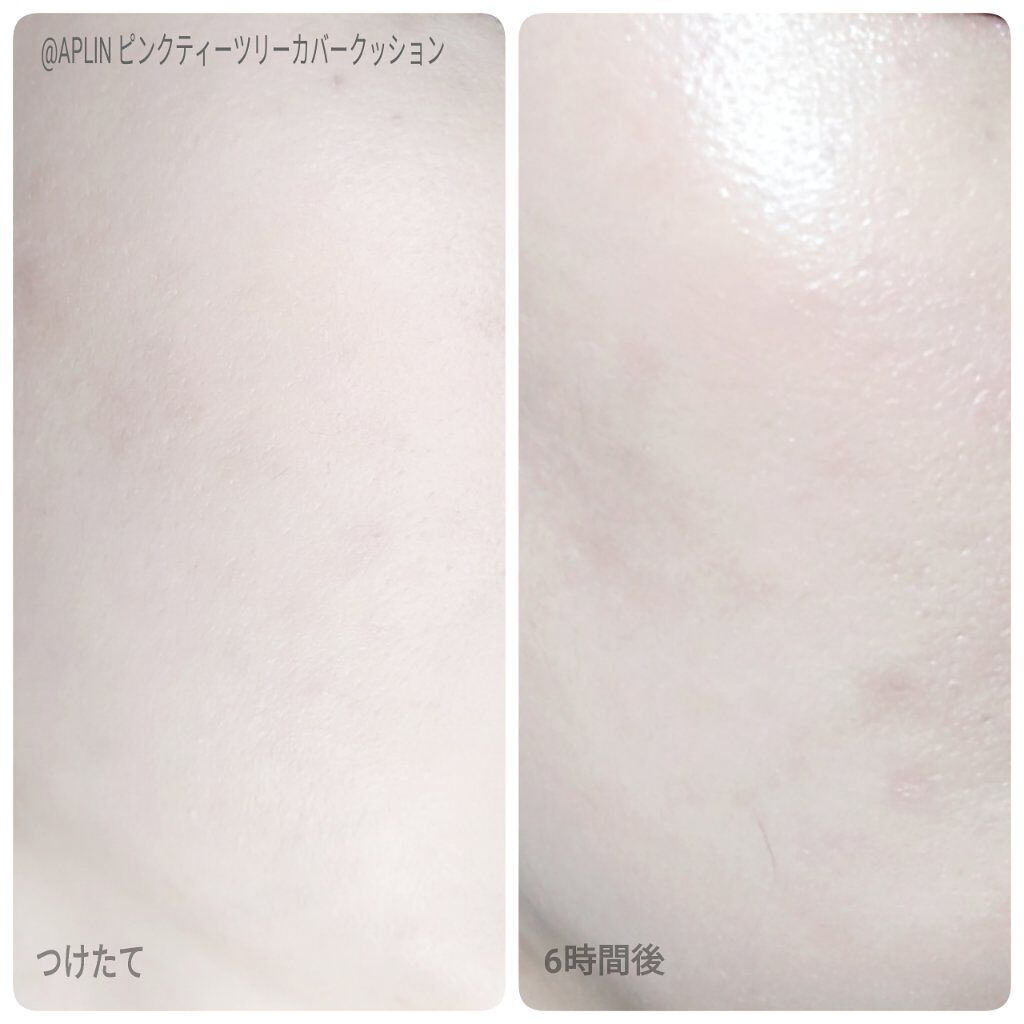 ピンクティーツリーカバークッション/APLIN/クッションファンデーションを使ったクチコミ(4枚目)