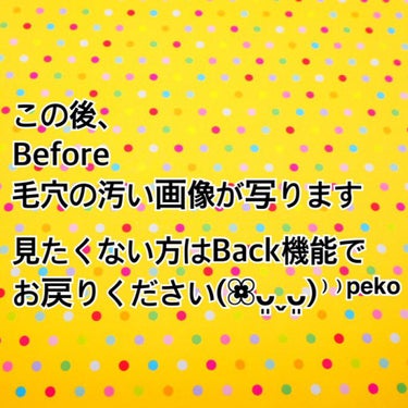 　Mikity on LIPS 「超音波ウォーターピーリング美顔器買いました‼️毛穴、いちご鼻が..」（7枚目）