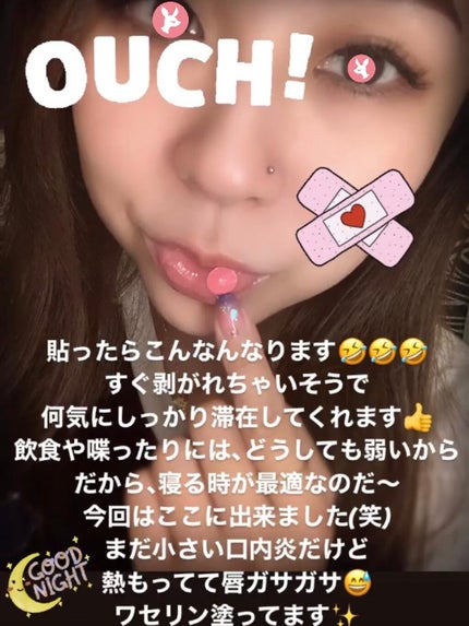 コンクールF/ウエルテック/マウスウォッシュ・スプレーを使ったクチコミ(4枚目)