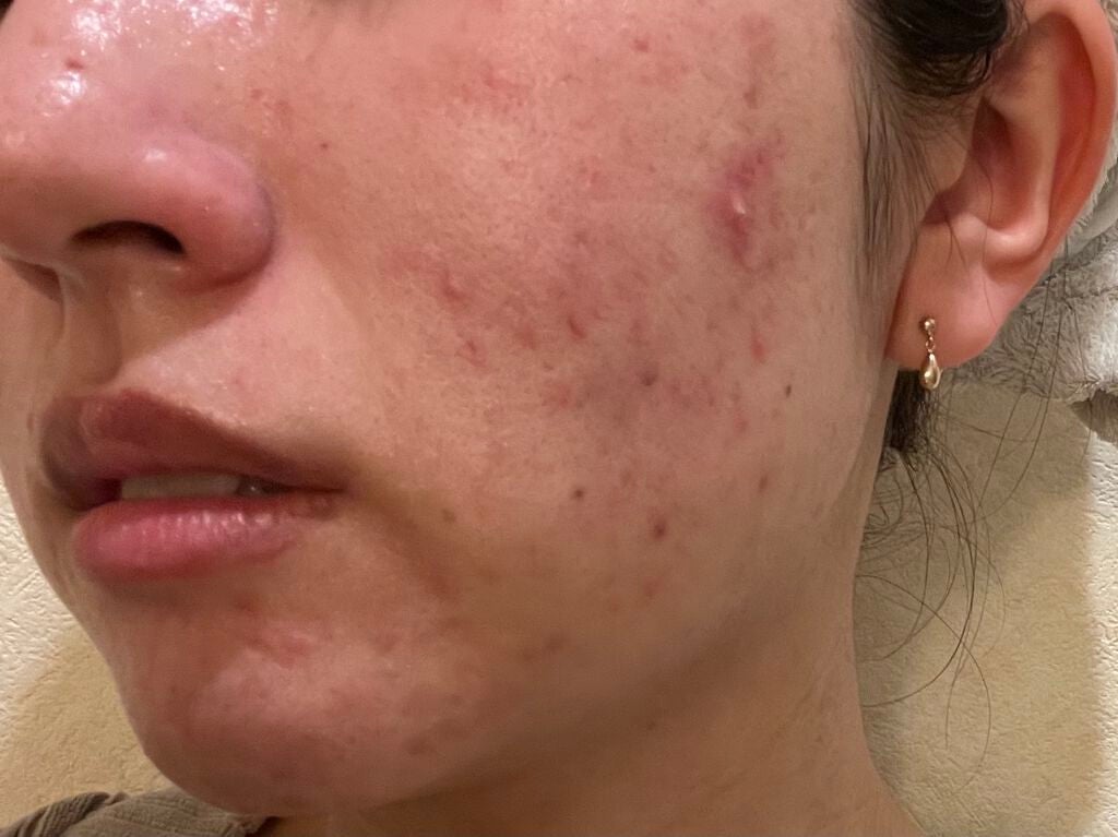 クレイウォッシュ/b.glen/洗顔フォームを使ったクチコミ(2枚目)