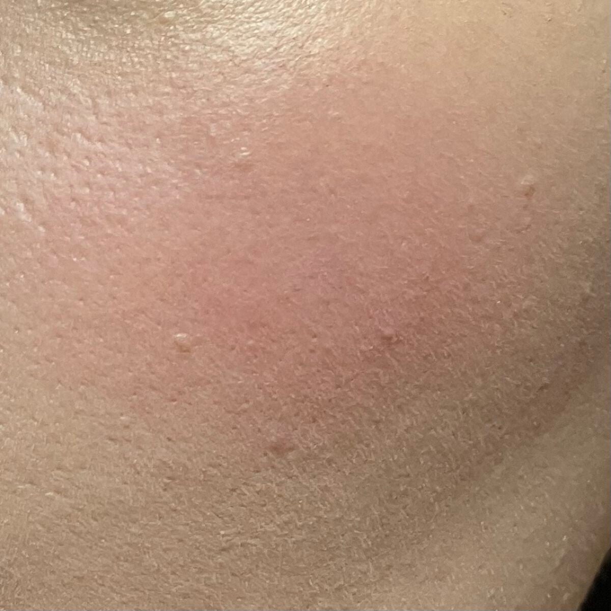 スキニーリッチチーク/excel/パウダーチークを使ったクチコミ(3枚目)