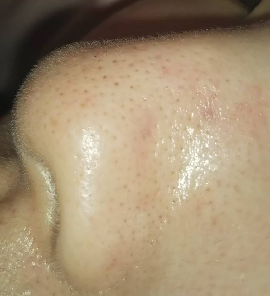 ロゼット洗顔パスタ 海泥スムース/ロゼット/洗顔フォームを使ったクチコミ(3枚目)