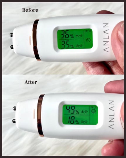 チェリーブロッサムブレミッシュ8GFセラム/Bring Back/化粧水を使ったクチコミ(5枚目)