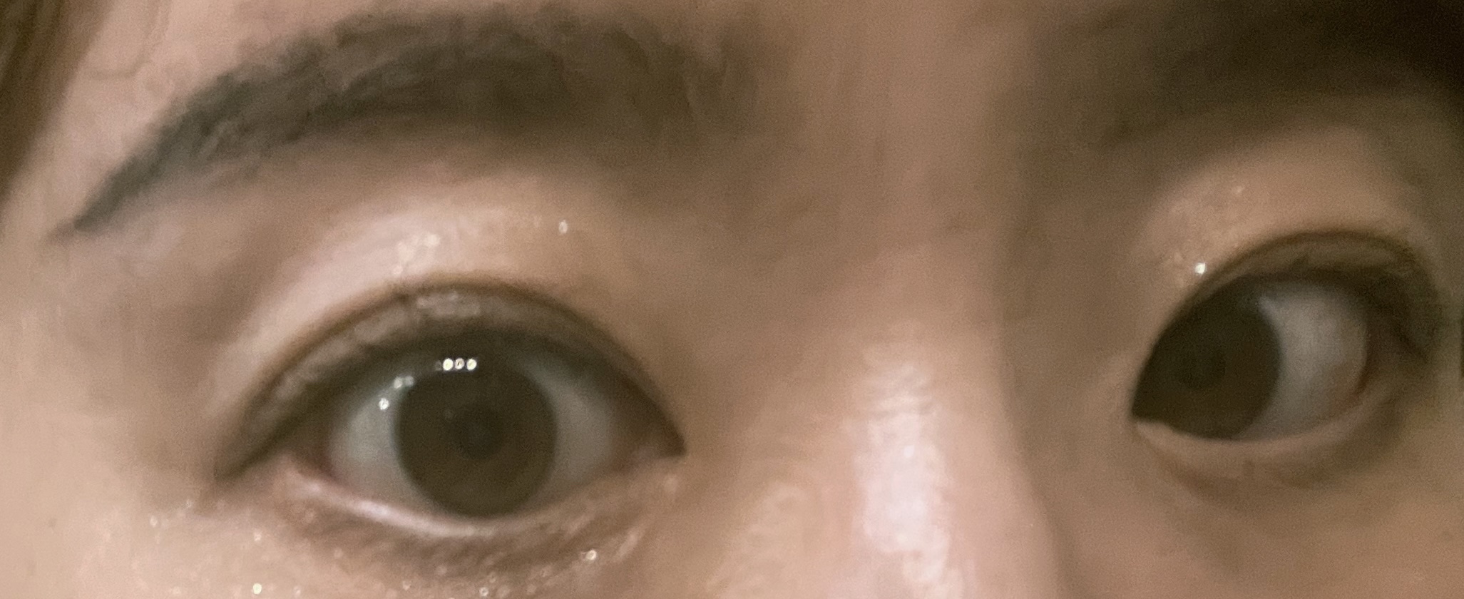 アイパワーセラム/グラングレイ/その他スキンケアを使ったクチコミ（3枚目）