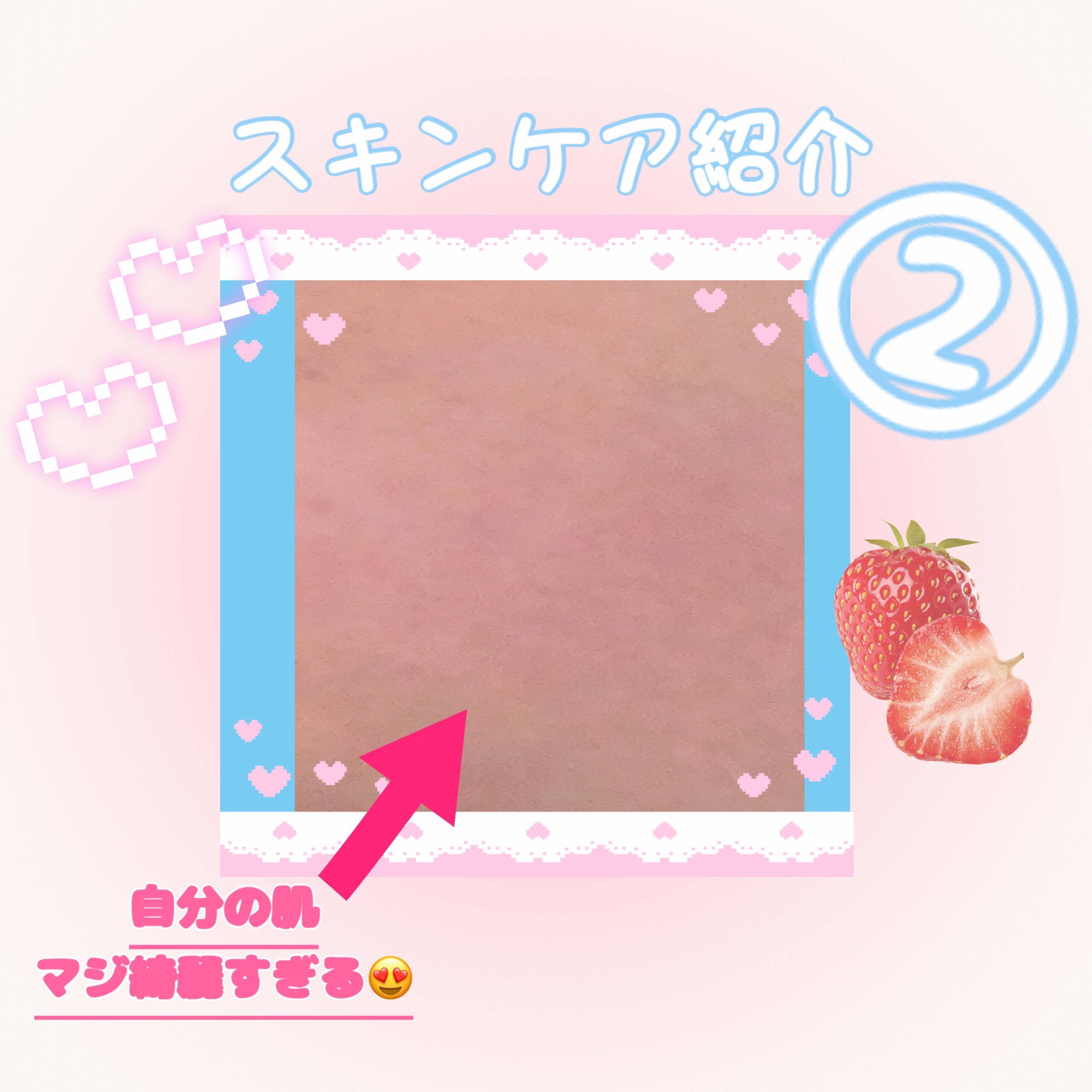 ペアアクネクリームW(医薬品)/ペア/その他を使ったクチコミ（1枚目）