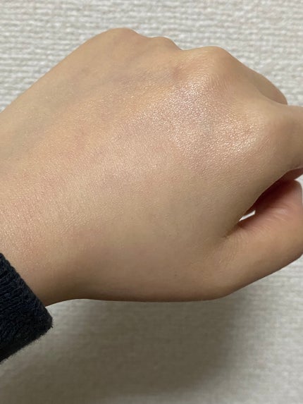 リンクルショット メディカル セラム N/リンクルショット/アイケア・アイクリームを使ったクチコミ(6枚目)