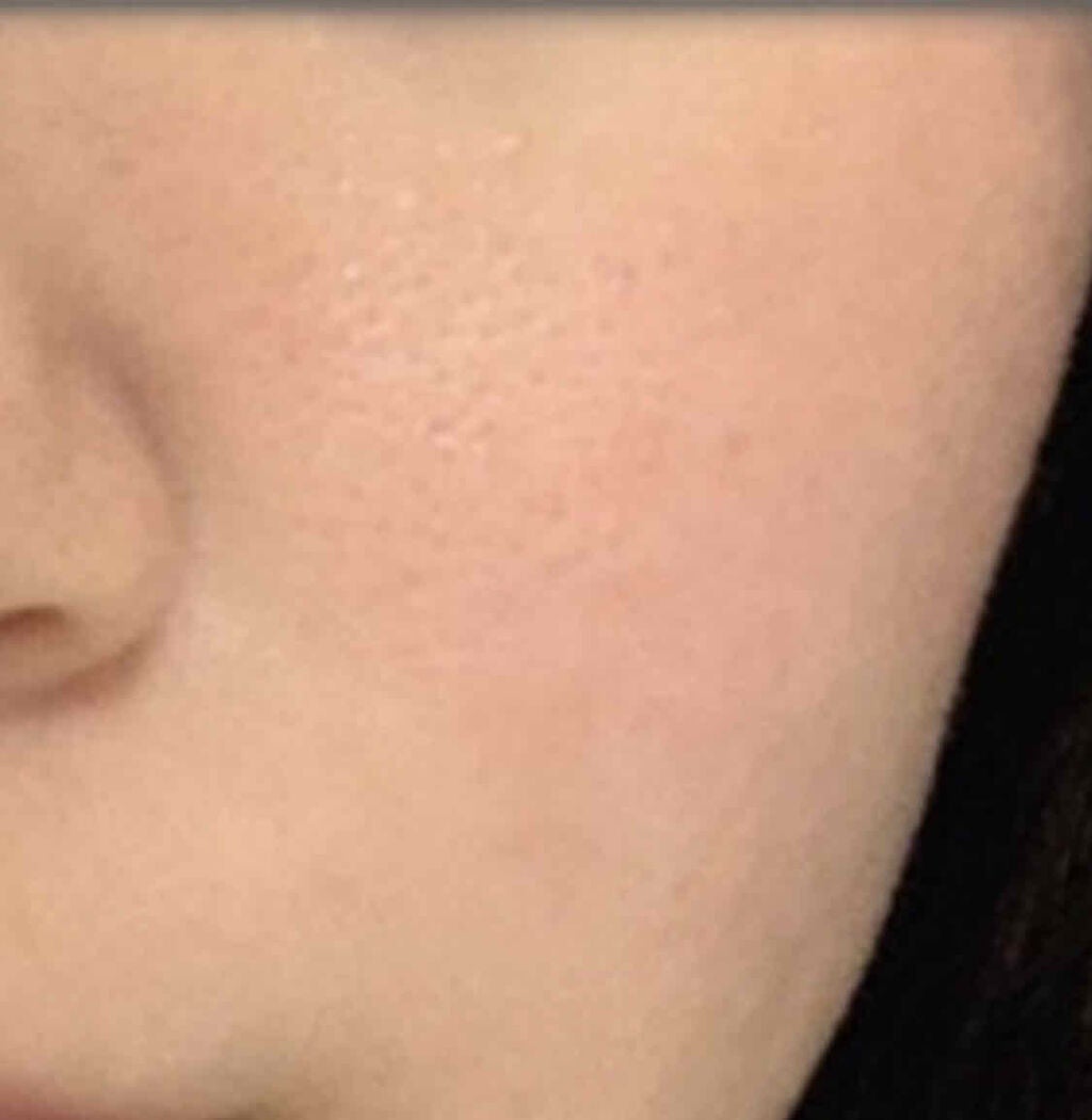 A アクネフォーム/NOV/洗顔フォームを使ったクチコミ(2枚目)