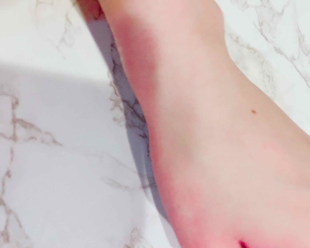 ナチュラルクッションピーリング/アカラン/ピーリングを使ったクチコミ(4枚目)