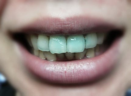 クリアクリーン プレミアム ホワイトクリアパックハミガキ/クリアクリーン/その他オーラルケアを使ったクチコミ(9枚目)