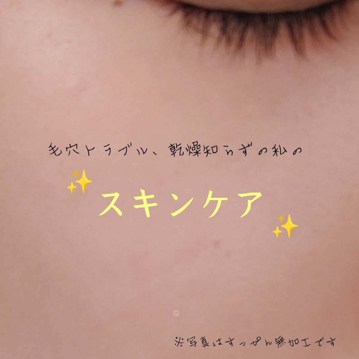 お米のマスク/毛穴撫子/シートマスク・パックを使ったクチコミ(1枚目)