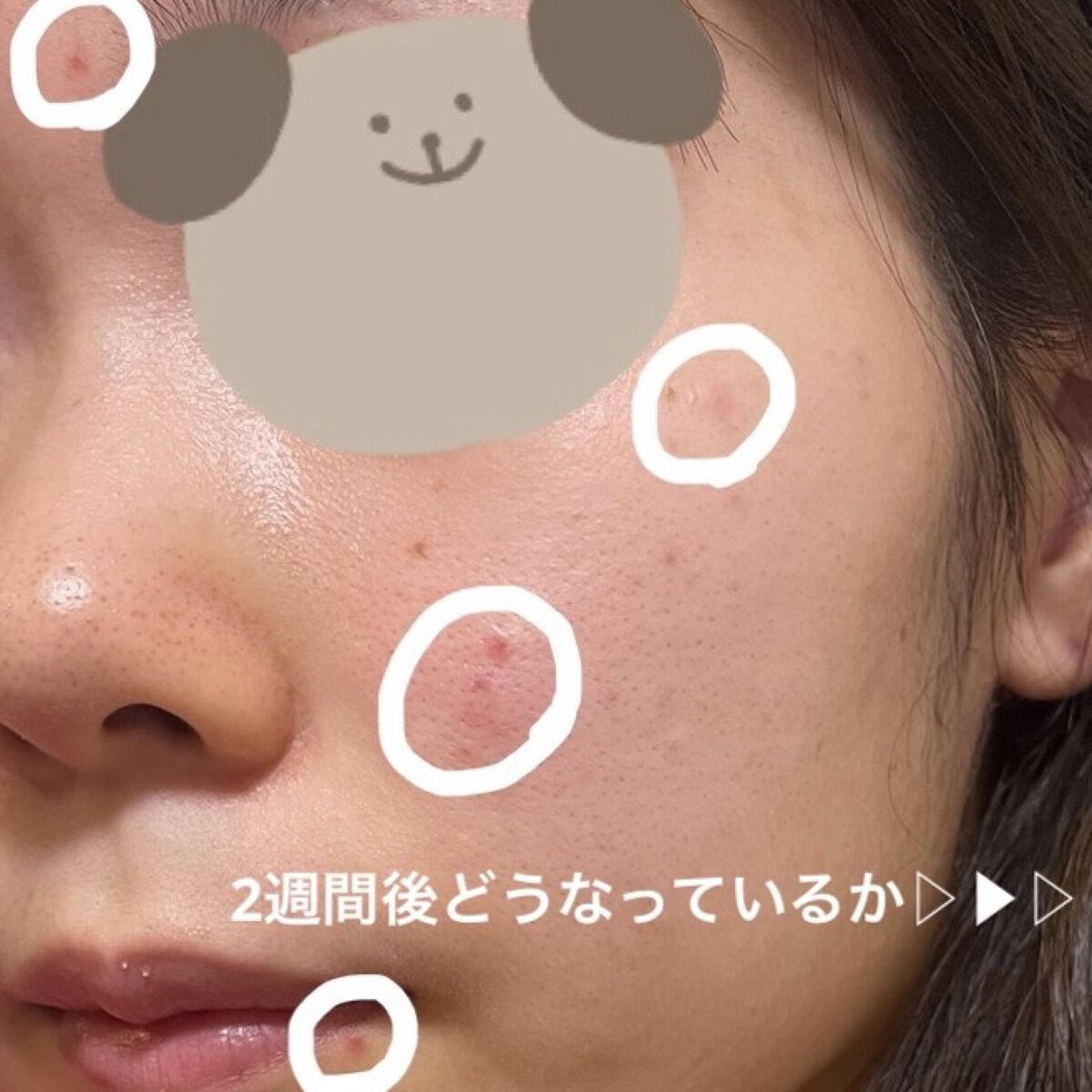 オードムーゲ 薬用ローション（ふきとり化粧水）/オードムーゲ/拭き取り化粧水を使ったクチコミ（1枚目）