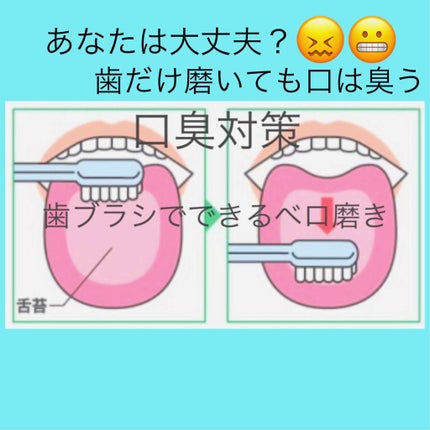 ステインクリア ペースト/オーラツー/歯磨き粉を使ったクチコミ(1枚目)