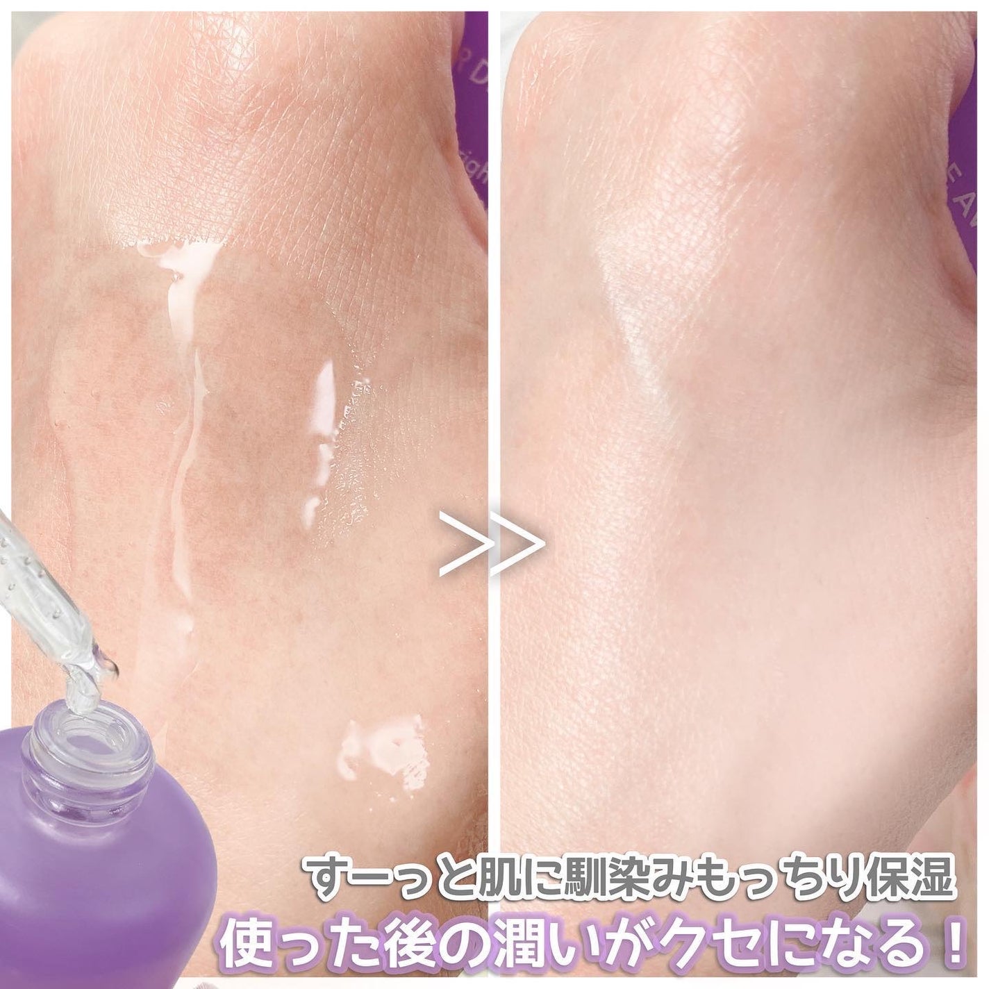 パーフェクト ブライトニングブルーベリー70 ビタセラム /JAR DE AWESOME/美容液を使ったクチコミ(5枚目)