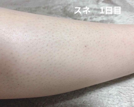 ブラウンシルクエキスパート (光美容器)/ブラウン/家庭用脱毛器を使ったクチコミ(3枚目)