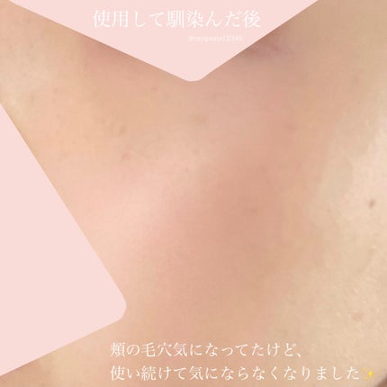 ピトピディーアールエヌ カプセルショット アンプル/One-day's you/美容液を使ったクチコミ(4枚目)