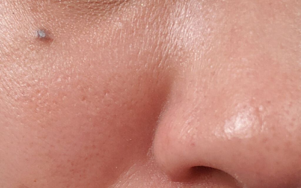 AHA 30% + BHA 2% Peeling Solution/The Ordinary/ピーリングを使ったクチコミ（2枚目）