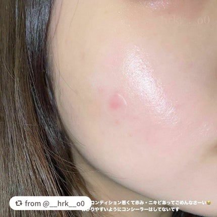 ティーツリーカーミングスポットパッチ/MEDIHEAL/その他スキンケアを使ったクチコミ(2枚目)