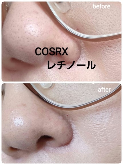 RXザ・レチノール0.1クリーム/COSRX/フェイスクリームを使ったクチコミ(1枚目)