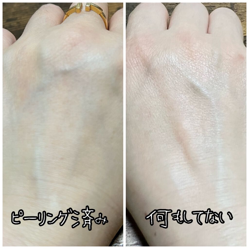 ホワイトクリアジェル/Cure/ピーリングを使ったクチコミ（3枚目）