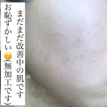 キル カバー グロウ クッション 04 GINGER/CLIO/クッションファンデーションを使ったクチコミ(3枚目)