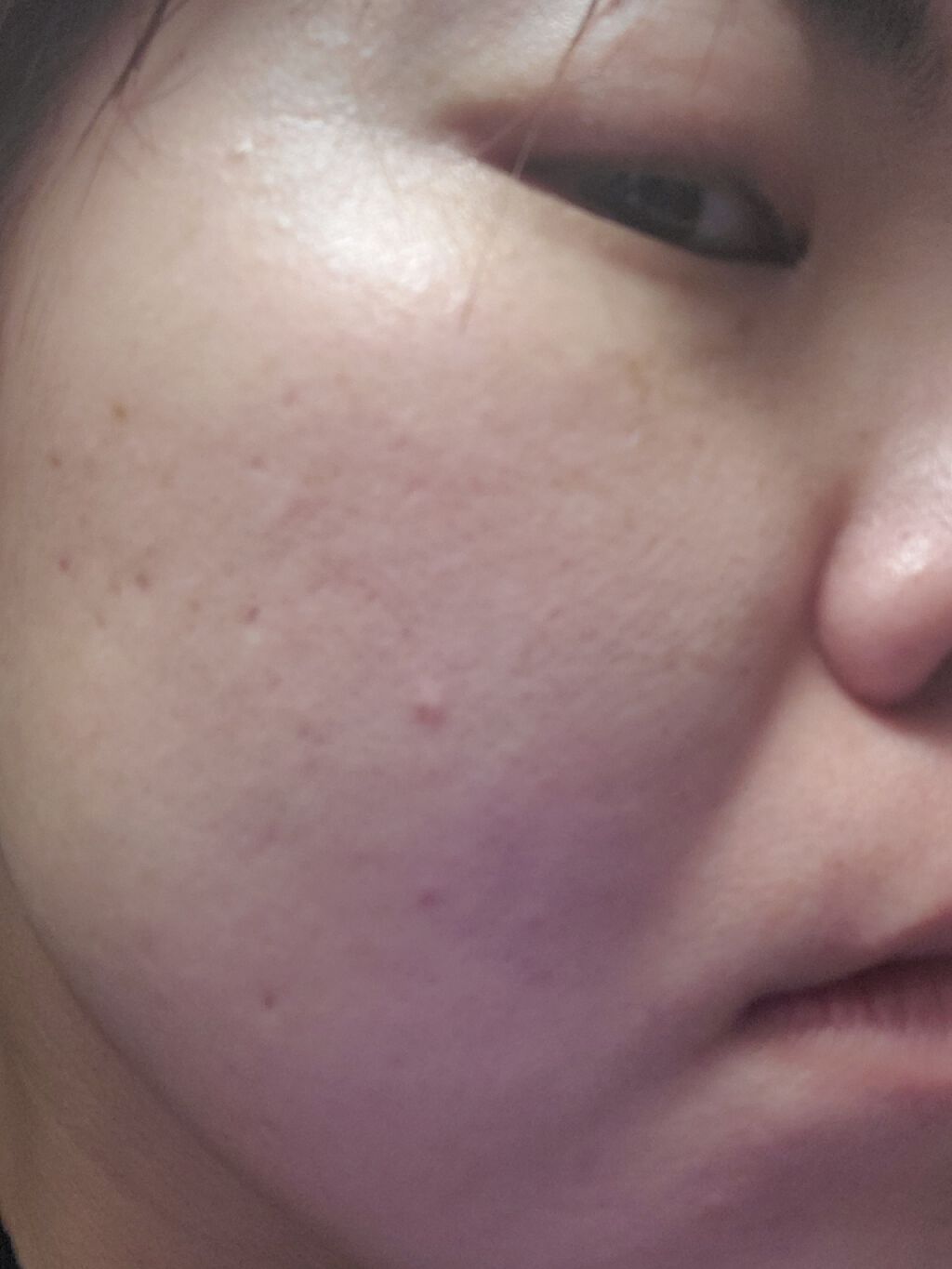 スキンコンディショナー ノーマルタイプ/ルナメアAC/化粧水を使ったクチコミ（1枚目）