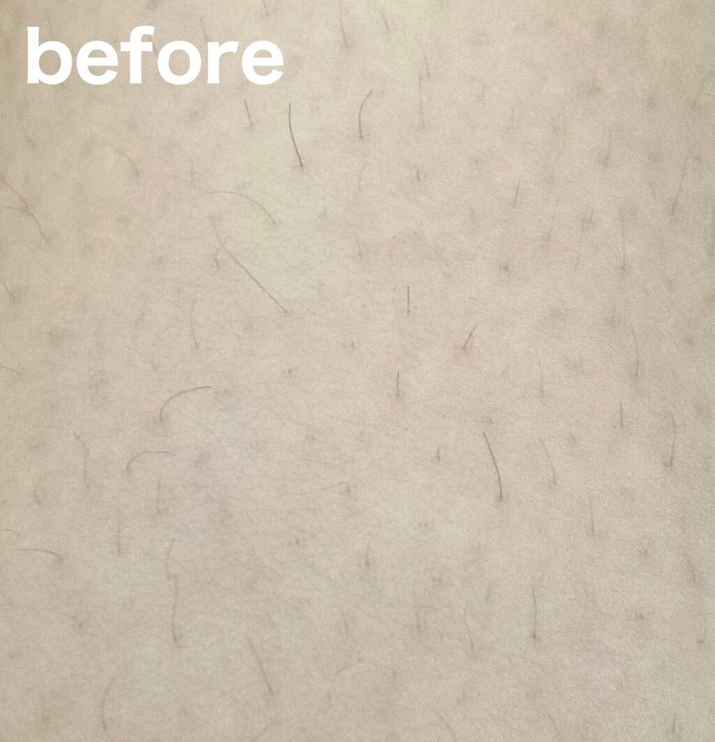 つるすべ除毛パッド/DAISO/ムダ毛ケアを使ったクチコミ（3枚目）