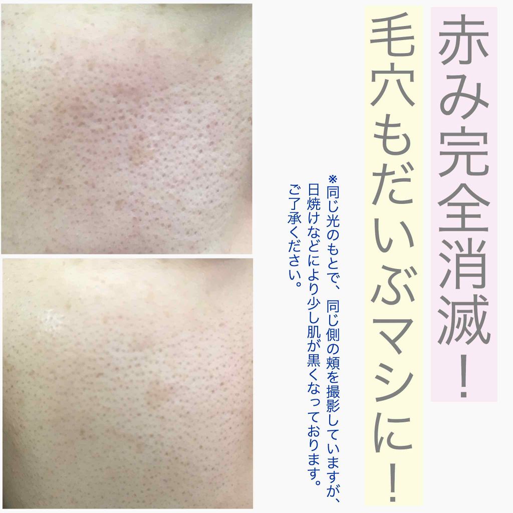 Cセラム/b.glen/美容液を使ったクチコミ(2枚目)