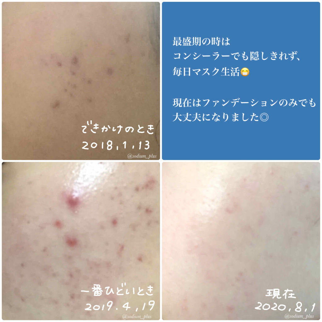 白潤 薬用美白化粧水/肌ラボ/化粧水を使ったクチコミ（2枚目）