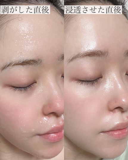 SOKSAL かっさ/MEDITHERAPY/かっさプレートを使ったクチコミ(10枚目)