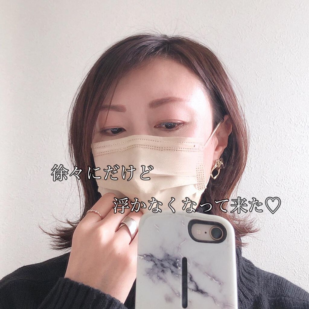 モウダス 薬用 発毛促進剤/北の快適工房/頭皮ローションを使ったクチコミ（3枚目）