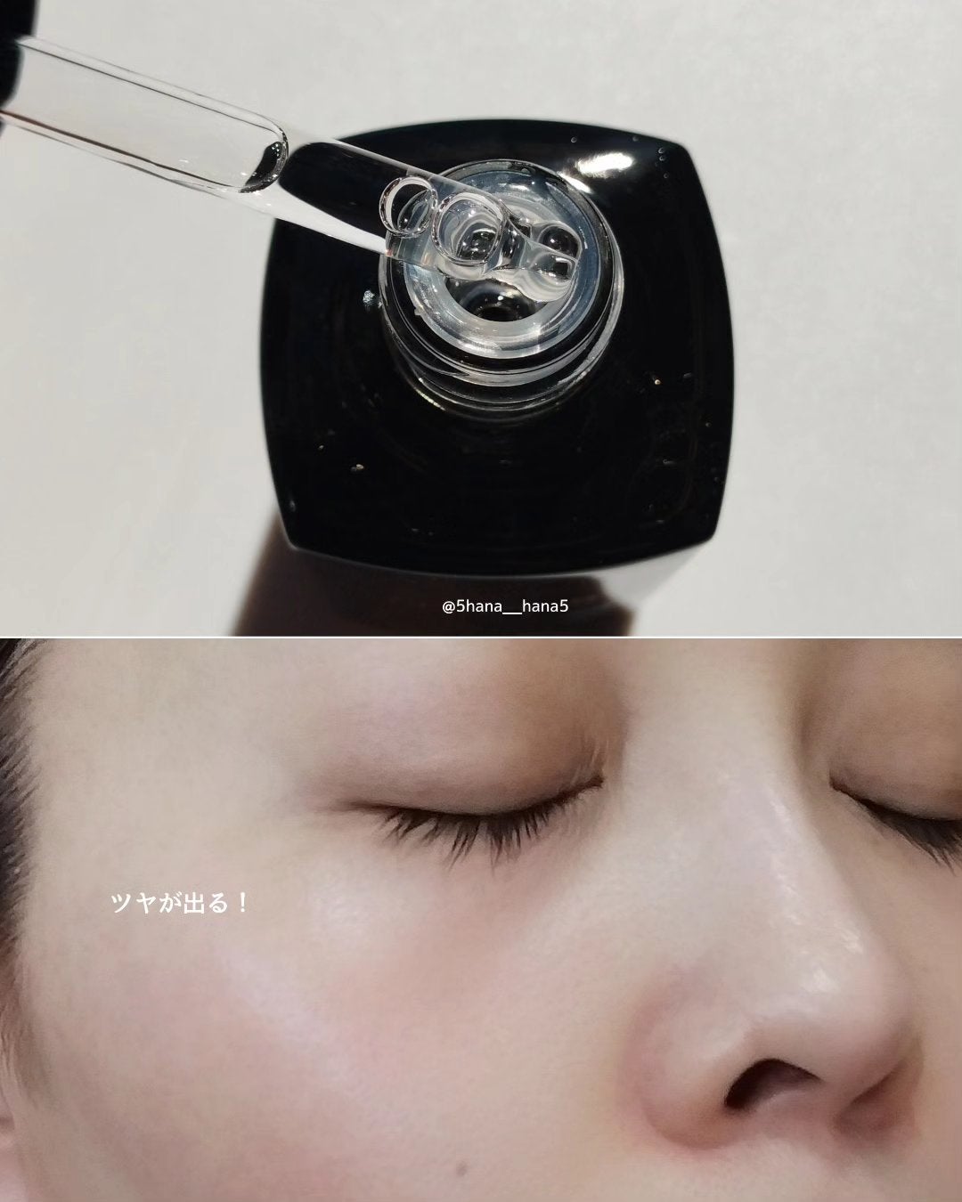 ã«ããšãŒã« ãŽã¡ã€ã¿ã«C/FEMMUE/ããŒã¹ã¿ãŒã»å°å
¥æ¶²ã䜿ã£ãã¯ãã³ãïŒ3æç®ïŒ