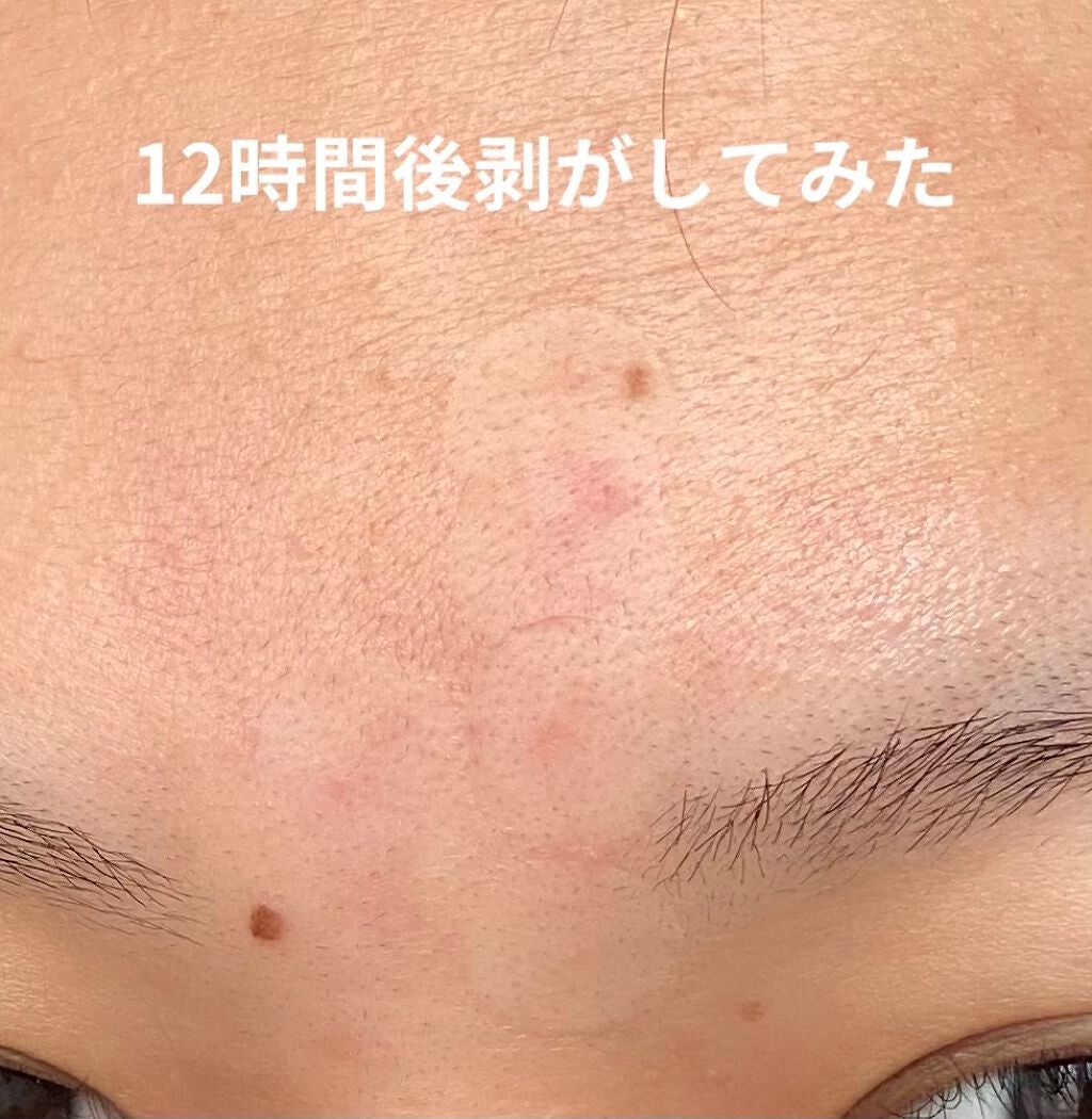 プロCICA クリアスポットパッチ/VT/その他スキンケアを使ったクチコミ(4枚目)