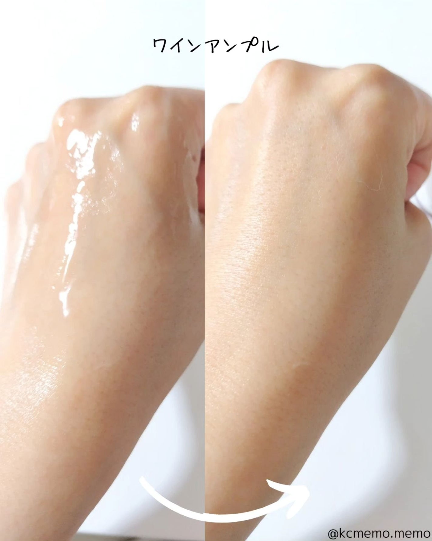 メモ魔ちゃん@韓国コスメメモ日記 on LIPS 「特許!ガラス玉アンプルとは❓️本日のメモ✍️イスキア♡ヒアルサ..」(7枚目)