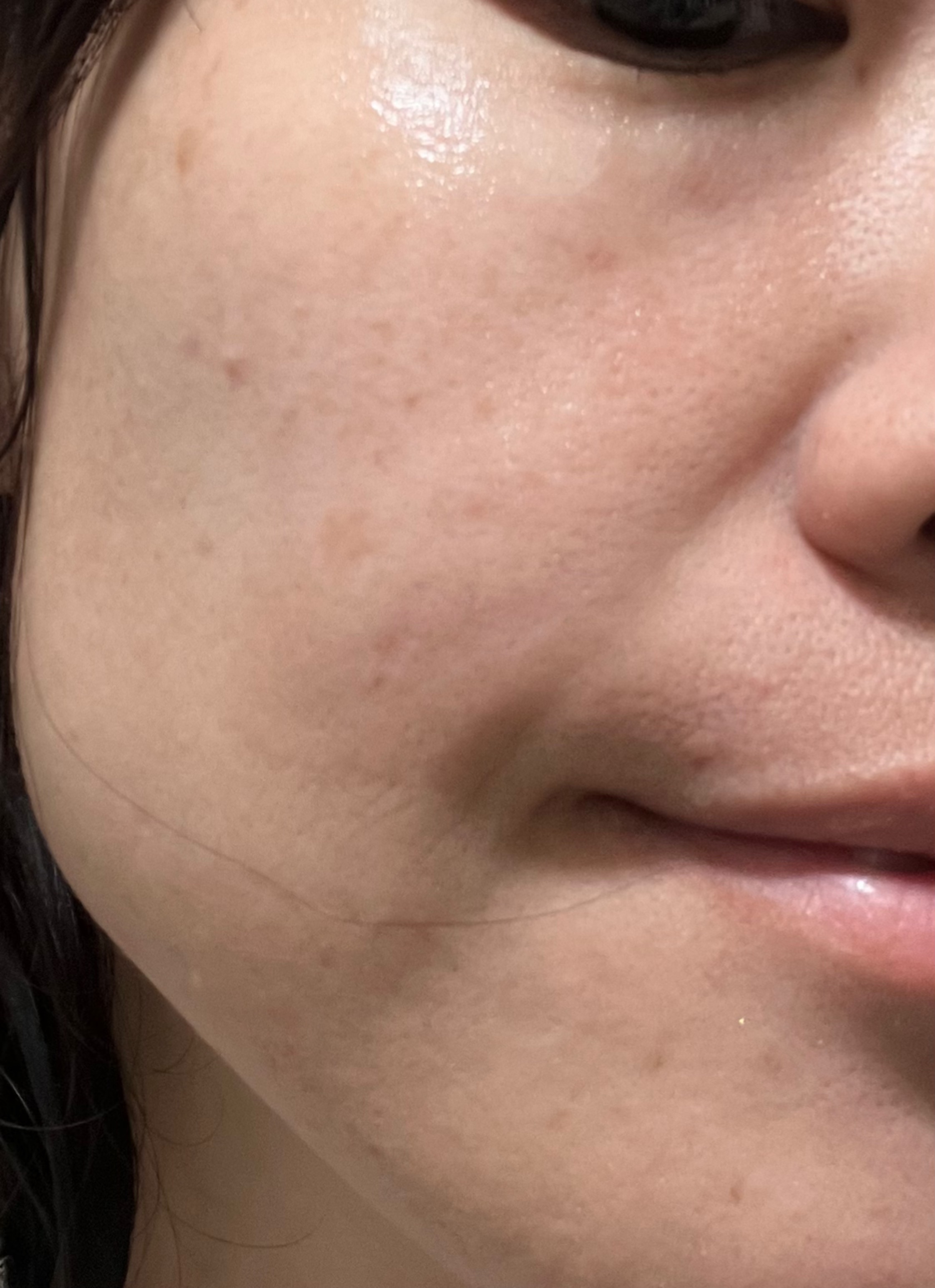 センテラ クイックカーミングパッド/SKIN1004/トナーパッドを使ったクチコミ（2枚目）