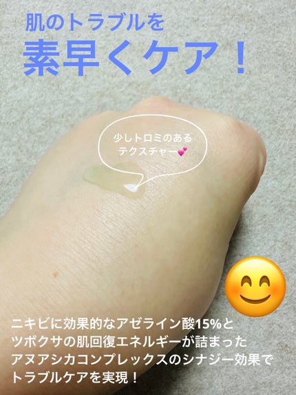 アゼライン酸15 インテンスカーミングセラム/Anua/美容液を使ったクチコミ(3枚目)