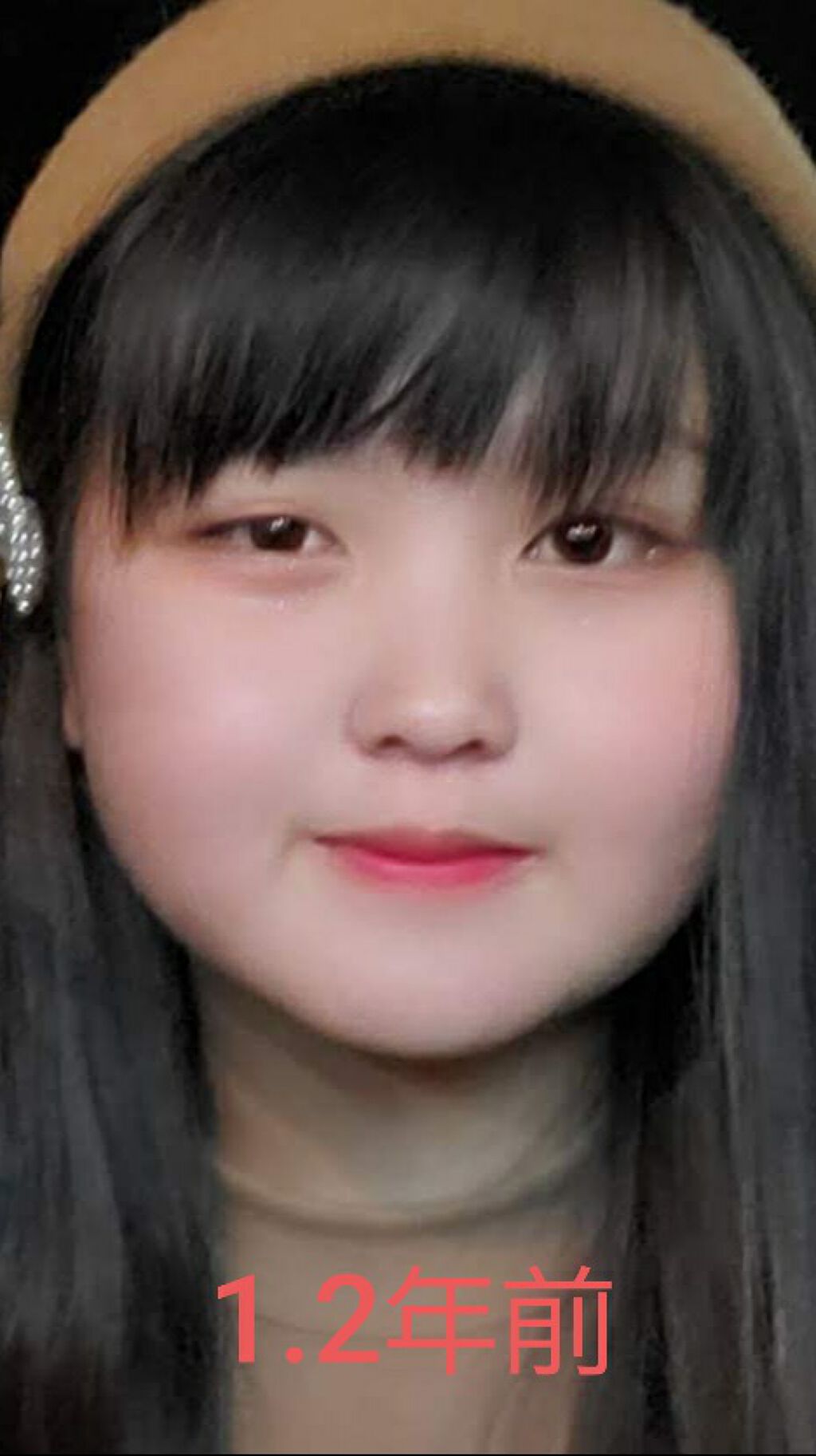 mio on LIPS 「私結構前までは、いちばん最初にある写真の通り私は芋女でした。今..」(1枚目)