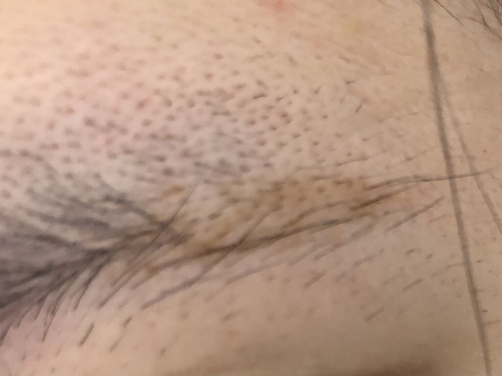 スカルプD ボーテ　ピュアフリーアイブロウセラム/アンファー(スカルプD)/その他アイブロウを使ったクチコミ（3枚目）