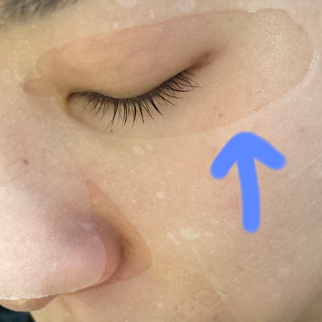 ティーツリーケアソリューション アンプルマスクJEX/MEDIHEAL/シートマスク・パックを使ったクチコミ(2枚目)